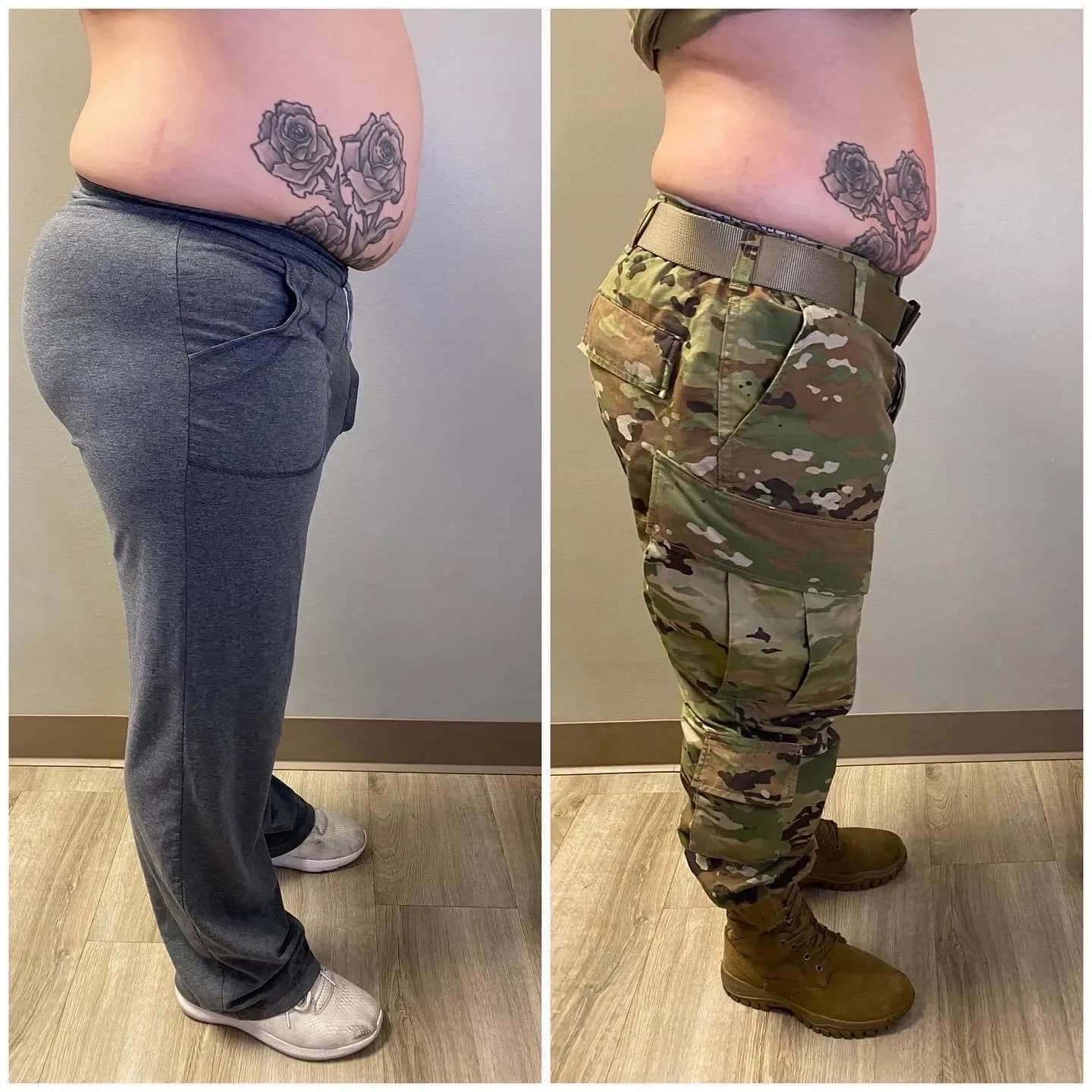 Neveskin body contouring before and after — waistline